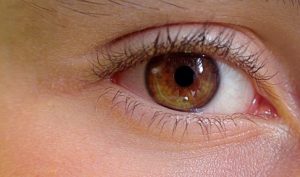 eyelid